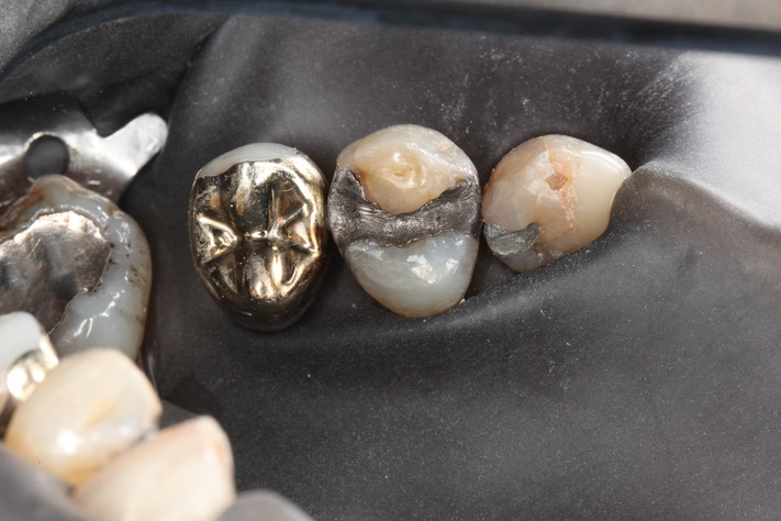 Alan Chinn #12 pre-op