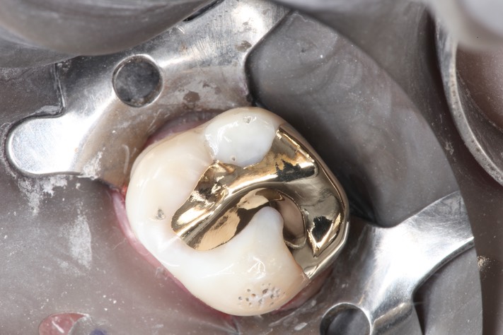 Kyle Chock #2 finish