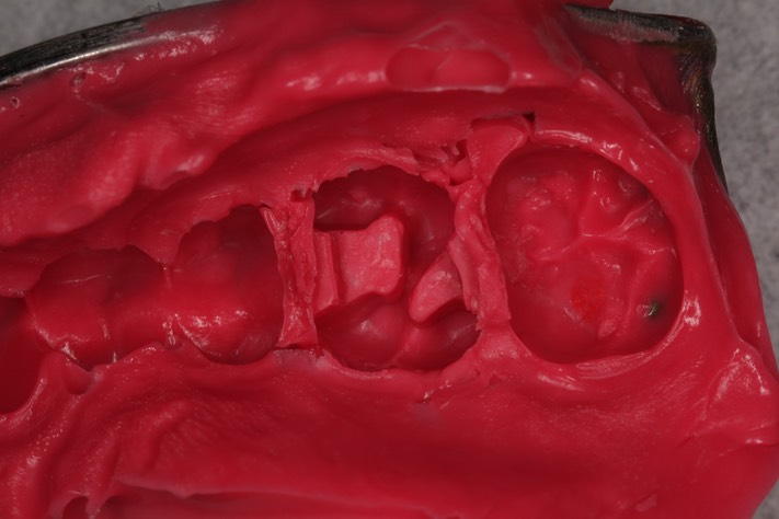 Ted Kanamori #3 impression