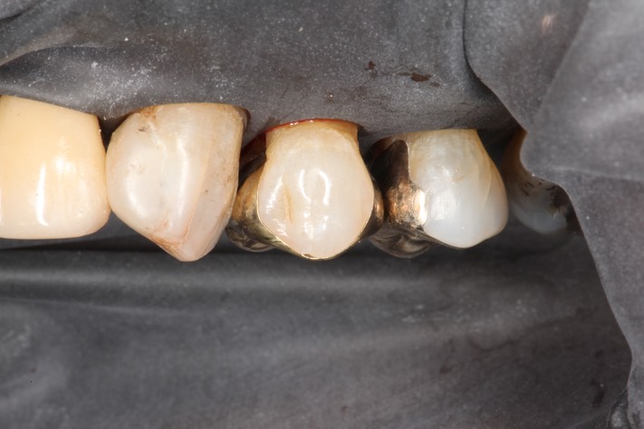 Alan Chinn #12 try in