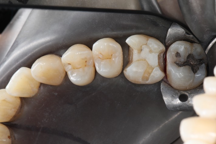 Larry Fujioka #3 prep 