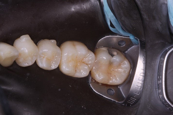 Carla Fukumoto #18 pre-op