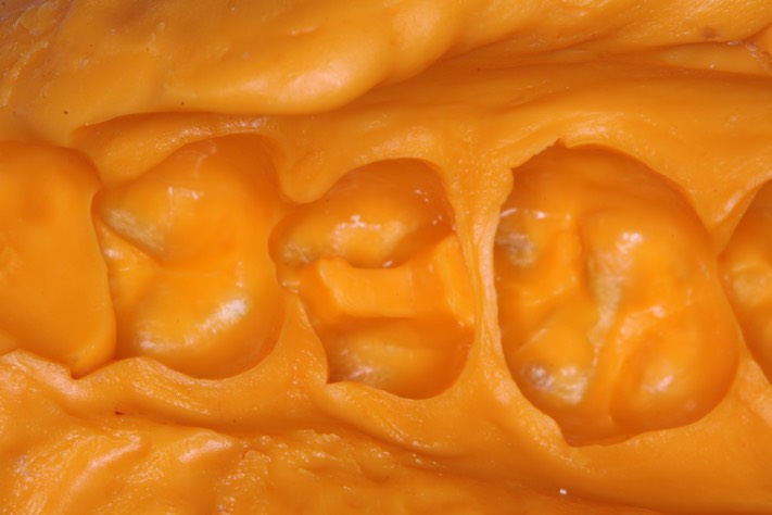 Mason Savage #4 impression