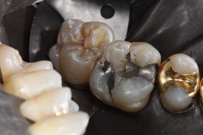 Steph Wong #14 pre-op