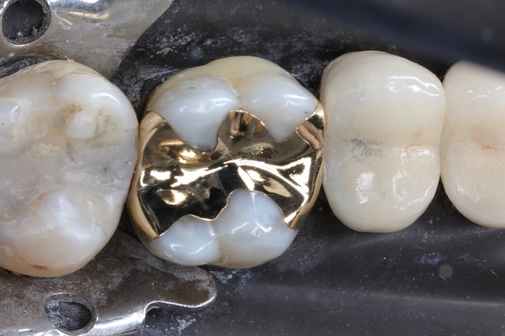 Kyle Chock #14 finish