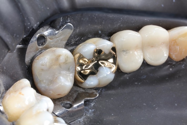 Kyle Chock #14 finish