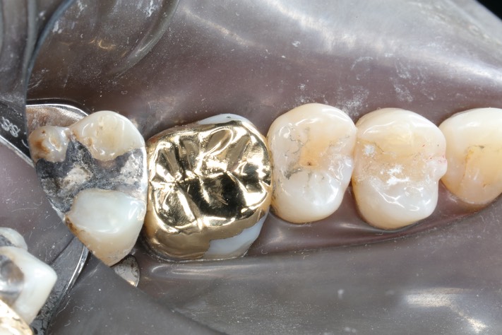 Kyle Chock #14 finish