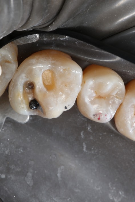 Kyle Chock #14 prep with pin