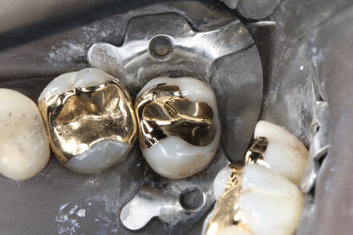 Kyle Chock #2 finish