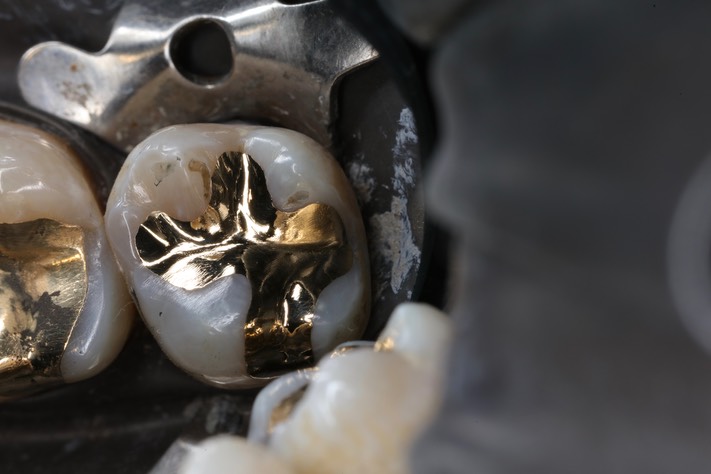 Kyle Chock #2 finish