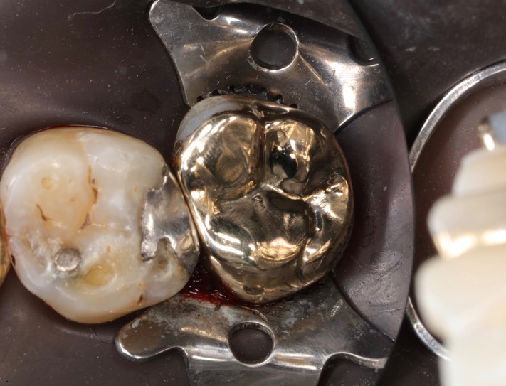 Kyle Chock #2 finish