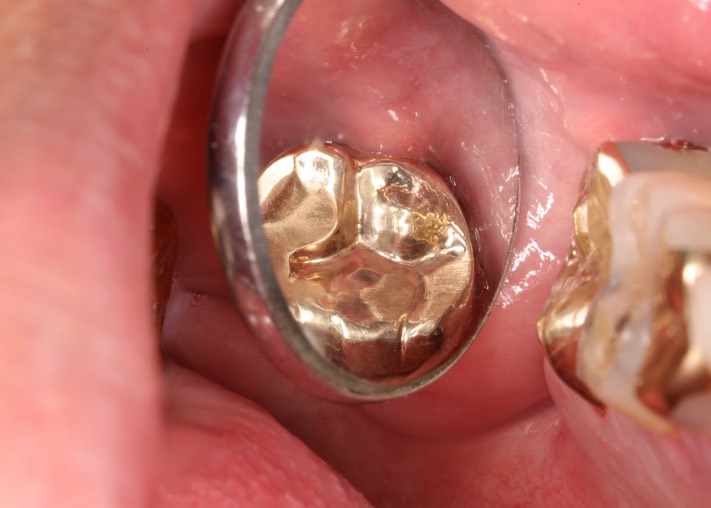 Kyle Chock #2 mirror