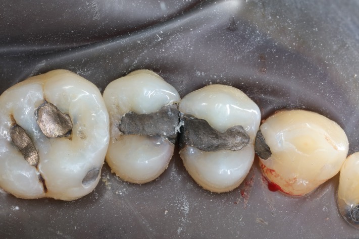 Larry Fujioka #12-13 pre-op