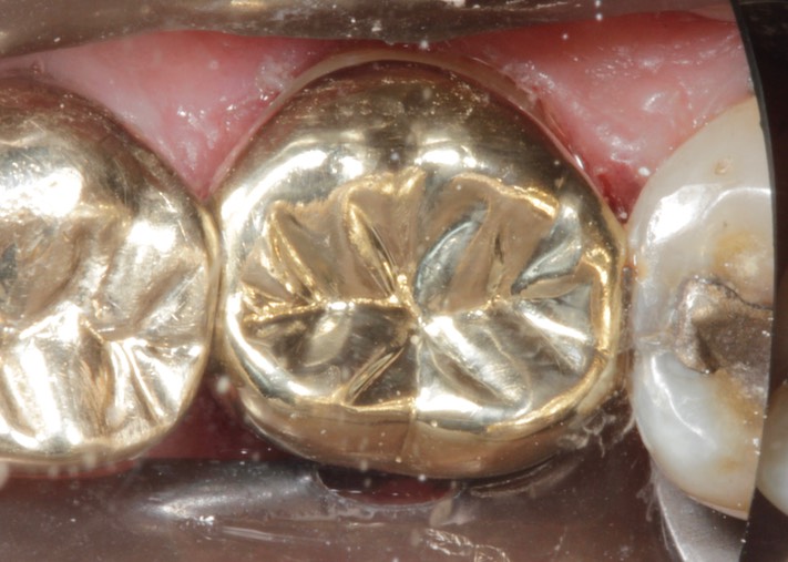 Larry Fujioka #18 finish