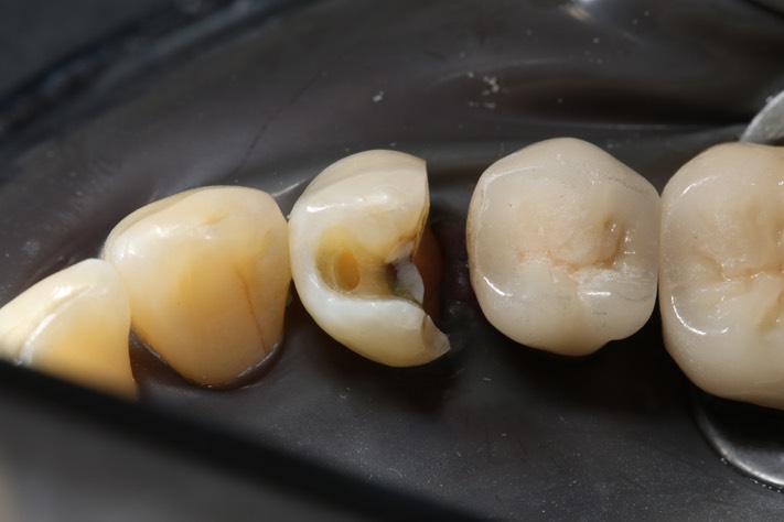 Larry Fujioka #21 prep