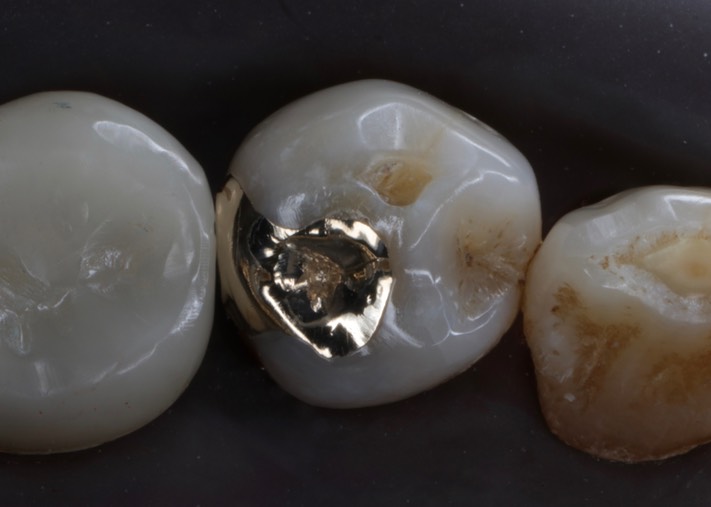 Larry Fujioka #28 finish