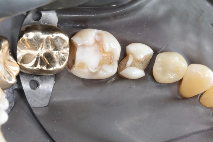 Larry Fujioka #29-30 prep