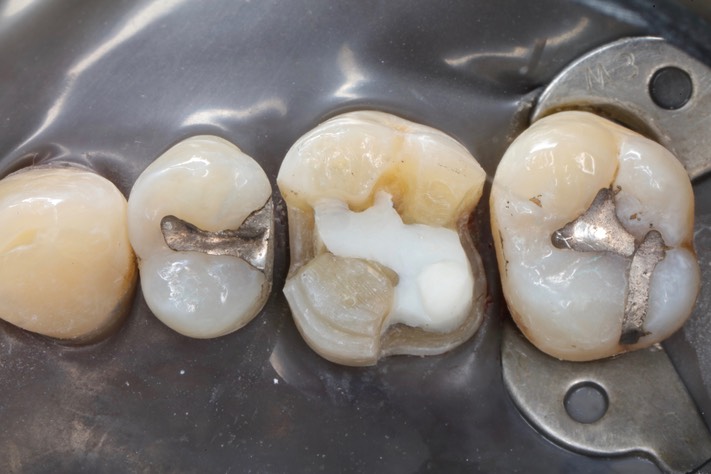 Larry Fujioka #3 prep