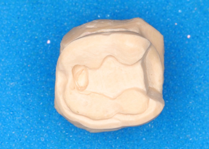 Larry Fujioka #31 die