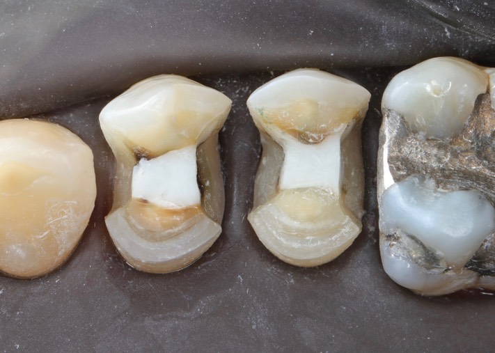 Larry Fujioka #4-5 prep 2