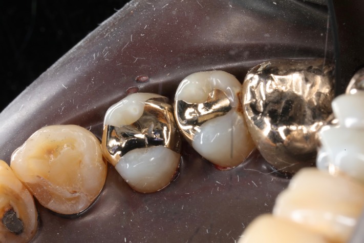 Larry Fujioka finish