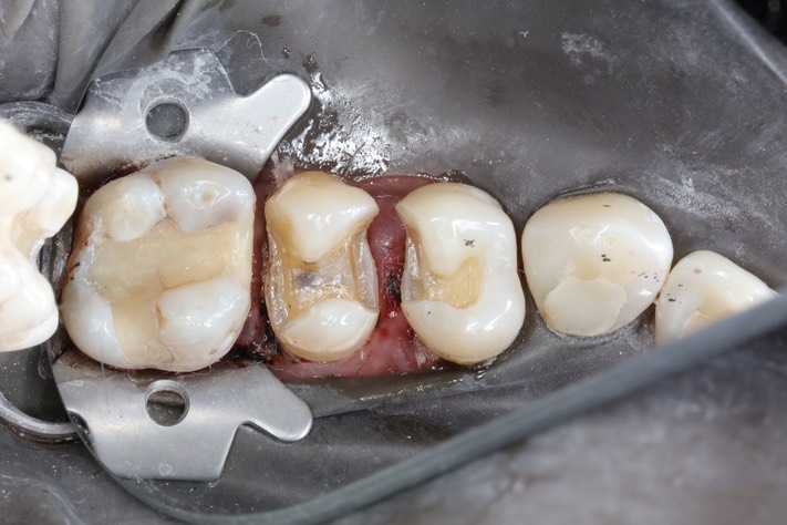 Mark Chun #12-13 prep