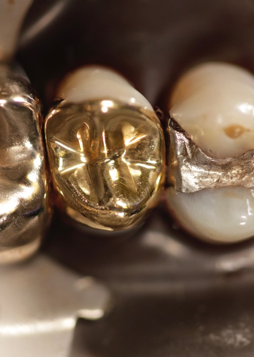 Mark Chun #13 finish