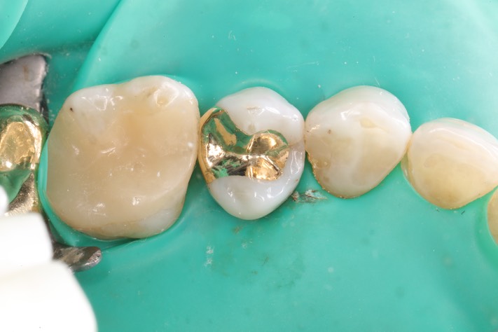 Mark Chun #13 finish