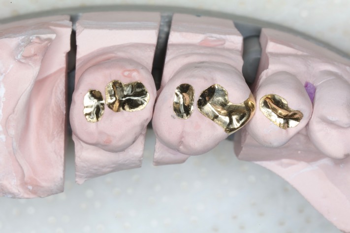 Mark Chun #13,14,15 castings on model