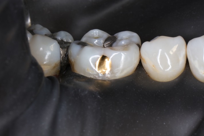 Mark Chun #30 finish