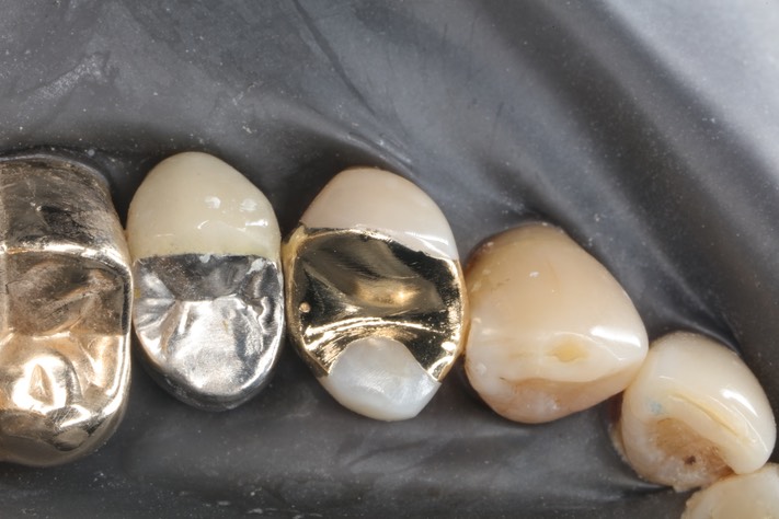 Matt Dodson #12 finish