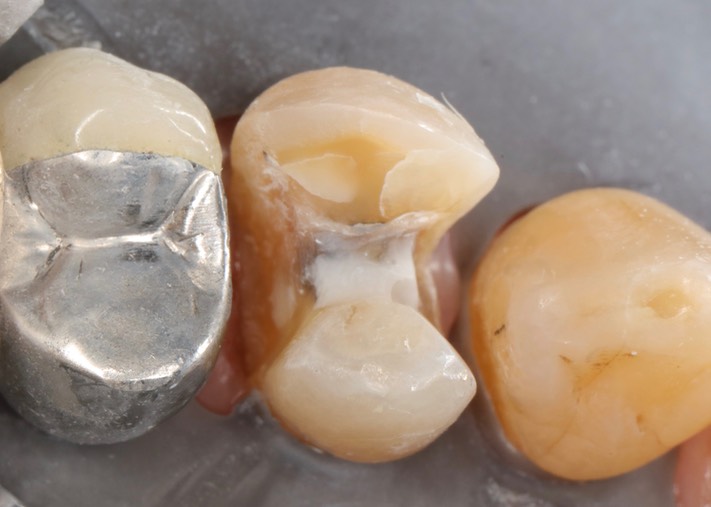 Matt Dodson #12 magnified