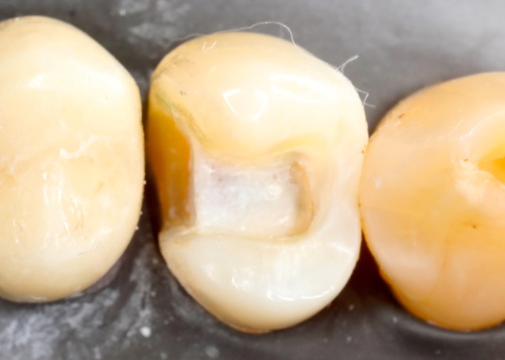 Matt Dodson #12 prep