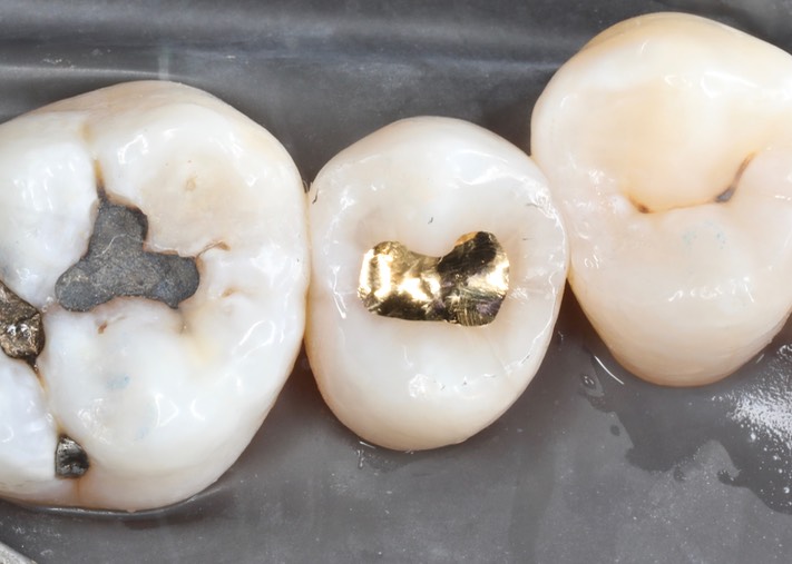 Matt Dodson #13 finish