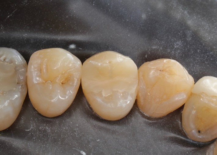 Matt Dodson #13 pre-op