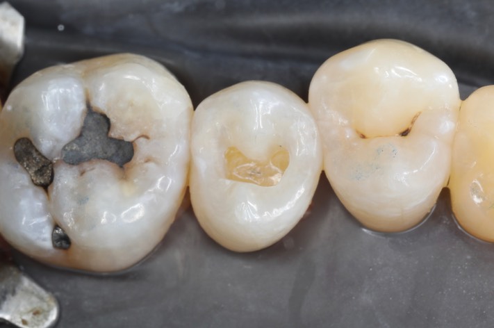 Matt Dodson #13 prep