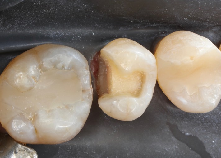 Matt Dodson #13 prep