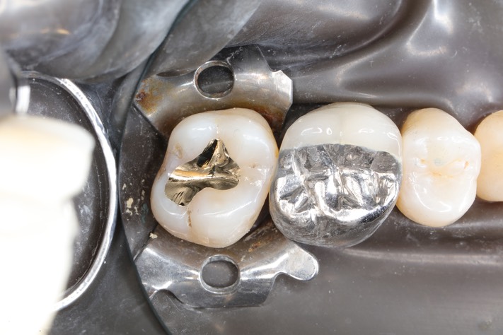 Matt Dodson #15 finish