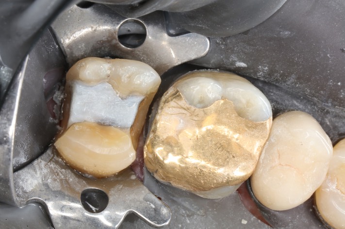 Matt Dodson #15 prep