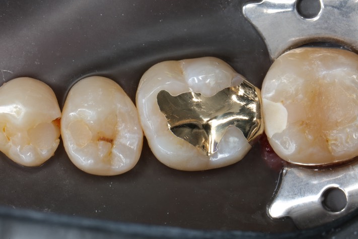 Matt Dodson #19 finish