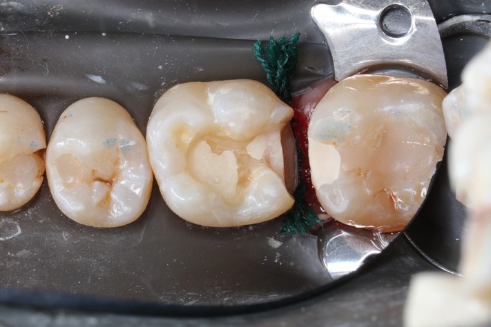 Matt Dodson #19 prep