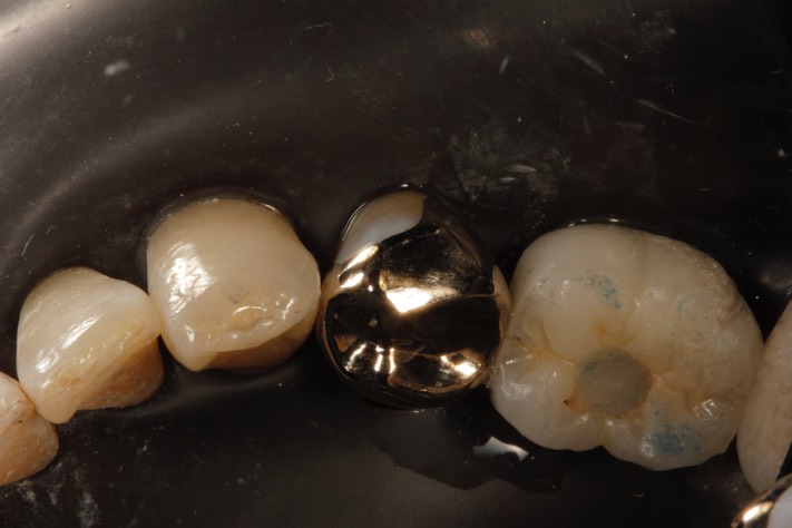 Matt Dodson #20 finish