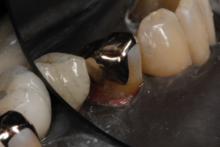 Matt Dodson #20 finis 2