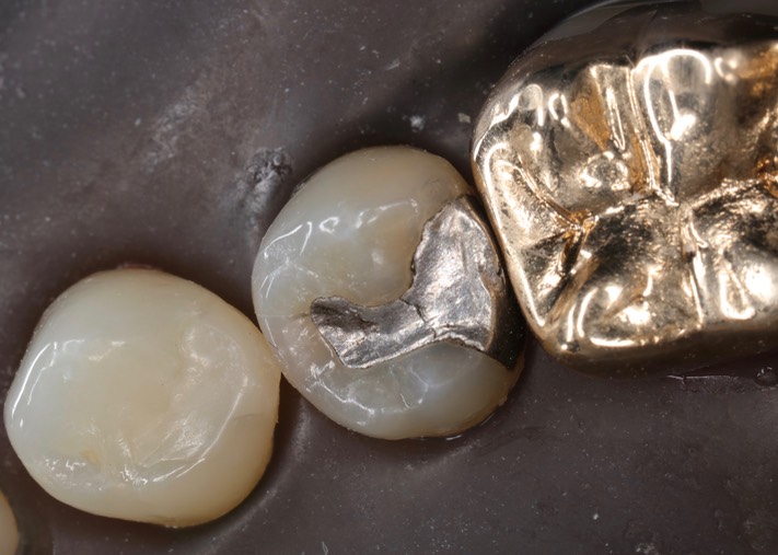 Matt Dodson #20 pre-op 