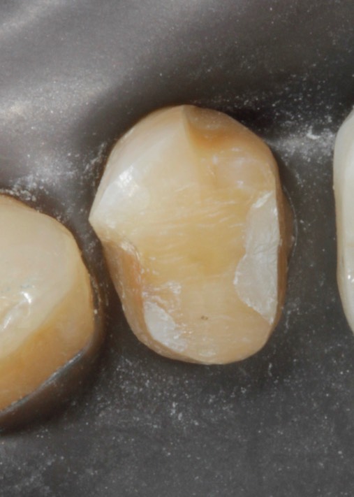 Matt Dodson #20 prep