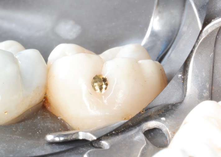 Matt Dodson #31 finish