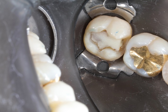 Matt Dodson #31 prep