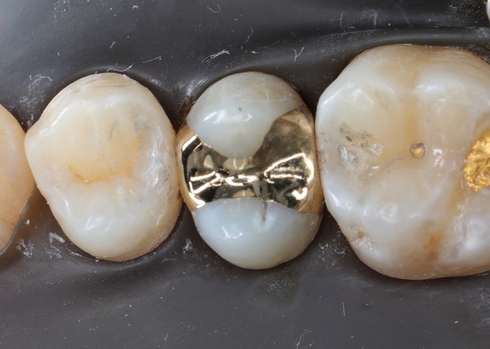 Matt Dodson #4 finish