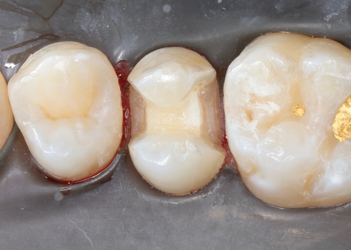 Matt Dodson #4 prep 1