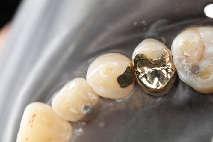 Matt Dodson #5-6 finish